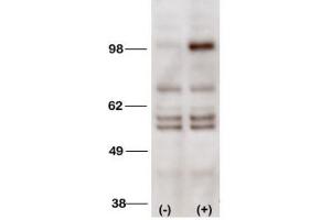 Western Blotting (WB) image for anti-Phosphoinositide-3-Kinase, Class 3 (PIK3C3) antibody (ABIN3000296) (PIK3C3 抗体)