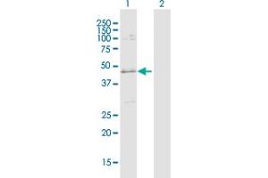Western Blotting (WB) image for anti-Solute Carrier Family 25 (Mitochondrial Carrier, Adenine Nucleotide Translocator), Member 31 (SLC25A31) (AA 1-315) antibody (ABIN529427)