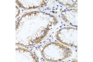 Immunohistochemistry of paraffin-embedded human stomach using GPM6A antibody at dilution of 1:100 (x40 lens). (GPM6A 抗体)