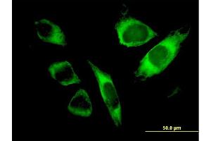 Immunofluorescence of monoclonal antibody to SPATA2 on HeLa cell. (SPATA2 抗体  (AA 422-519))