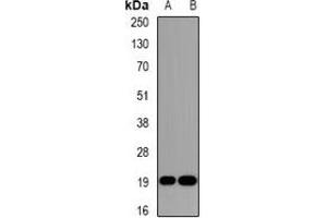 Western blot analysis of DR1 expression in Jurkat (A), HepG2 (B) whole cell lysates. (DR1 抗体)
