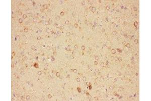 IHC-P: CNTF antibody testing of rat brain tissue (CNTF 抗体  (AA 2-200))
