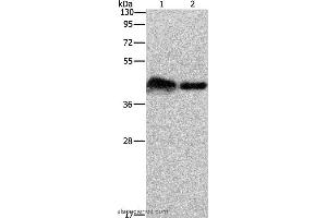 Western blot analysis of Mouse bladder tissue and 293T cell, using CRELD1 Polyclonal Antibody at dilution of 1:930