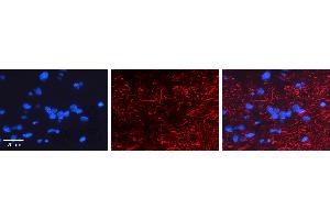 RGS6 antibody - C-terminal region          Formalin Fixed Paraffin Embedded Tissue:  Human Pineal Tissue    Observed Staining:  Cytoplasm and Membrane of Human Pineal Tissue   Primary Antibody Concentration:  1:100    Other Working Concentrations:  1/600    Secondary Antibody:  Donkey anti-Rabbit-Cy3    Secondary Antibody Concentration:  1:200    Magnification:  20X    Exposure Time:  0. (RGS6 抗体  (C-Term))