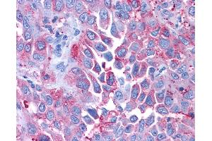 Immunohistochemistry (IHC) image for anti-Corticotropin Releasing Hormone Receptor 1 (CRHR1) (Extracellular Domain) antibody (ABIN1048462)