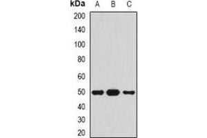 Western blot analysis of Serpin A4 expression in HepG2 (A), mouse pancreas (B), rat pancreas (C) whole cell lysates. (SERPINA4 抗体)