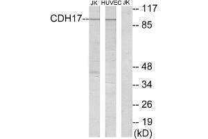 Western blot analysis of extracts from Jurkat cells and HUVEC cells, using CDH17 antibody. (LI Cadherin 抗体  (Internal Region))