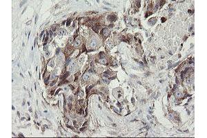 Image no. 9 for anti-Methionyl Aminopeptidase 2 (METAP2) (AA 2-212) antibody (ABIN1491153)