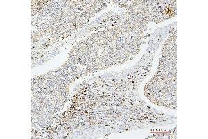 IHC analysis of CD43 using anti-CD43 antibody (ABIN7601042). (CD43 抗体  (AA 272-400))