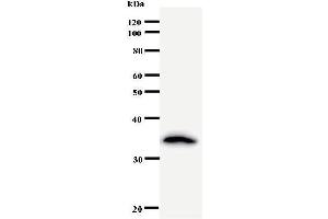 Western Blotting (WB) image for anti-Crooked Neck Pre-mRNA Splicing Factor-Like 1 (CRNKL1) antibody (ABIN931026) (CRNKL1 抗体)