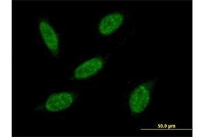 Immunofluorescence of purified MaxPab antibody to RNF20 on HeLa cell. (RNF20 抗体  (AA 1-975))