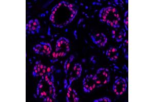 Immunofluorescence (IF) image for anti-Polybromo 1 (PBRM1) (AA 1-293) antibody (ABIN7454032)