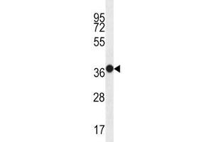 MUC15 antibody western blot analysis in WiDr lysate. (MUC15 抗体  (AA 209-237))