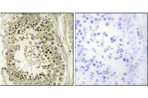 Immunohistochemistry analysis of paraffin-embedded human testis tissue using HGS antibody. (HGS 抗体)