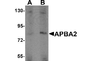 Western Blotting (WB) image for anti-Amyloid beta (A4) Precursor Protein-Binding, Family A, Member 2 (APBA2) (Middle Region) antibody (ABIN1030857)