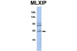 Host:  Rabbit  Target Name:  MLXIP  Sample Type:  OVCAR-3  Antibody Dilution:  1.