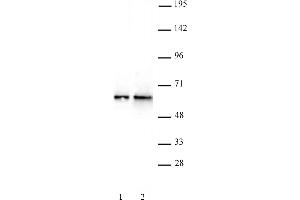DMAP1 antibody (pAb) tested by Western blot. (DMAP1 抗体  (C-Term))