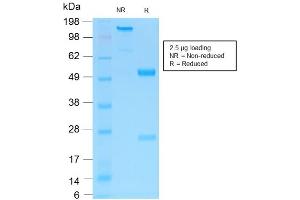 SDS-PAGE Analysis of Purified NGFR Rabbit Recombinant Monoclonal Antibody ABIN6383799. (Recombinant NGFR 抗体)