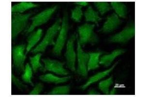 Immunostaining analysis in HeLa cells. (Transportin 3 抗体)