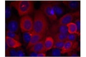 Image no. 1 for anti-3-phosphoinositide Dependent Protein Kinase-1 (PDPK1) (Ser241) antibody (ABIN197100) (PDPK1 抗体  (Ser241))