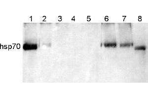 Image no. 1 for anti-Heat Shock Protein 70 (HSP70) (Cytoplasmic) antibody (ABIN334584) (HSP70 抗体  (Cytoplasmic))