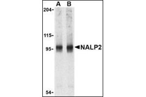 Western blot analysis of NALP2 in PC-3 cell lysate with this product at (A) 1 and (B) 2 μg/ml. (NLRP2 抗体  (C-Term))