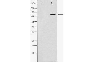 Western blot analysis of Hela whole cell lysates, using ABL1 Antibody. (ABL1 抗体  (N-Term))