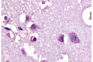 Anti-CRF1 antibody  ABIN1048460 IHC staining of human human brain, neurons and glia. (CRHR1 抗体  (N-Term))