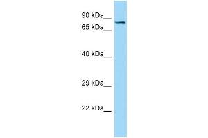 WB Suggested Anti-SEMA7A Antibody Titration: 1. (SEMA7A 抗体  (C-Term))