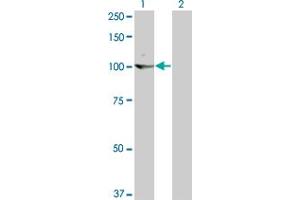 Western Blot analysis of KIT expression in transfected 293T cell line by KIT monoclonal antibody (M02), clone 6F2. (KIT 抗体  (AA 41-140))