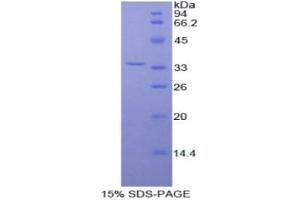 SDS-PAGE analysis of Rat Fibulin 3 Protein.