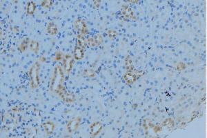 ABIN6279027 at 1/100 staining Mouse kidney tissue by IHC-P. (MRPL53 抗体  (Internal Region))