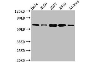 Western Blot Positive WB detected in: Hela whole cell lysate, HL60 whole cell lysate, 293T whole cell lysate, A549 whole cell lysate, Mouse kidney tissue All lanes: SLAMF6 antibody at 5. (SLAMF6 抗体  (AA 248-331))