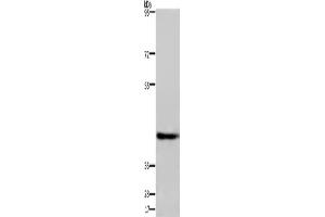 Western Blotting (WB) image for anti-Developmentally Regulated GTP Binding Protein 1 (DRG1) antibody (ABIN2429959) (DRG1 抗体)
