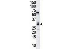 The DSCR1 antibody used in western blot to detect DSCR1 in endothelial tissue lysate (RCAN1 抗体  (AA 222-252))