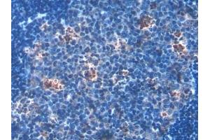 Detection of HSD17b12 in Mouse Lymph node Tissue using Polyclonal Antibody to 17-Beta-Hydroxysteroid Dehydrogenase Type 12 (HSD17b12)