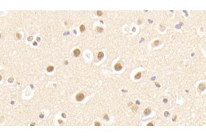 Detection of APPBP1 in Human Cerebrum Tissue using Polyclonal Antibody to Amyloid Beta Precursor Protein Binding Protein 1 (APPBP1) (NAE1 抗体  (AA 229-534))