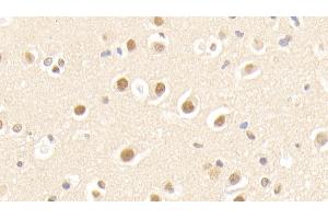 Detection of APPBP1 in Human Cerebrum Tissue using Polyclonal Antibody to Amyloid Beta Precursor Protein Binding Protein 1 (APPBP1) (Amyloid beta Precursor Protein Binding Protein 1 (AA 229-534) 抗体)
