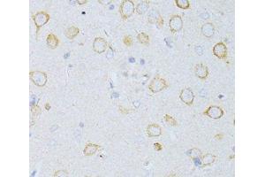 Immunohistochemistry of paraffin-embedded Rat brain using CD63 Polyclonal Antibody at dilution of 1:100 (40x lens). (CD63 抗体)