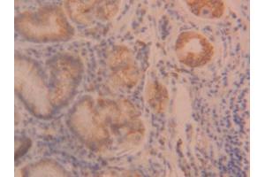 DAB staining on IHC-P; Samples: Human Stomach Tissue (ANGPTL2 抗体  (AA 267-493))