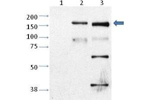 Western blot analysis of Trpm2 in CHO cells untransfected (Lane 1), CHO cell transfected with rat TRPM2 (Lane 2) and mouse cortical neurons (cultured) (Lane 3) with Trpm2 polyclonal antibody . (TRPM2 抗体  (AA 1430-1508))