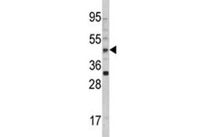 Western blot analysis of AADAC antibody and 293 lysate. (AADAC 抗体  (AA 273-300))