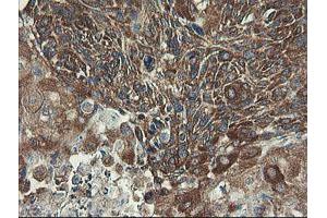 Image no. 1 for anti-Ubiquitin-Conjugating Enzyme E2, J1, U (UBE2J1) antibody (ABIN1501638) (UBE2J1 抗体)