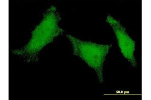 Immunofluorescence of monoclonal antibody to MED8 on HeLa cell. (MED8 抗体  (AA 1-59))