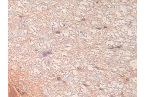 Detection of LXN in Rat Spinal Cord Tissue using Polyclonal Antibody to Latexin (LXN) (Latexin 抗体  (AA 1-223))