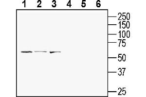 Western blot analysis of mouse  T-cell lymphoma cell line lysate (lanes 1 and 4), human Jurkat T-cell leukemia cell line lysate (lanes 2 and 5) and mouse  microglia cell line lysate (lanes 3 and 6):1-3. (GPR108 抗体  (Extracellular))