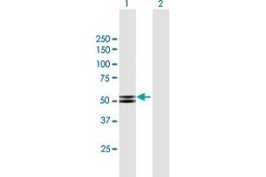 Western Blotting (WB) image for anti-Protein Kinase, CAMP-Dependent, Regulatory, Type II, beta (PRKAR2B) (AA 1-418) antibody (ABIN948314)