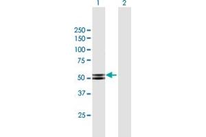 Western Blot analysis of PRKAR2B expression in transfected 293T cell line by PRKAR2B MaxPab polyclonal antibody.