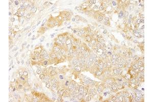 anti-Eukaryotic Translation Initiation Factor 3 Subunit J (EIF3S1) (AA 208-258) antibody