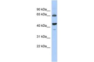 Western Blotting (WB) image for anti-Aldehyde Dehydrogenase 7 Family, Member A1 (ALDH7A1) antibody (ABIN2463934)